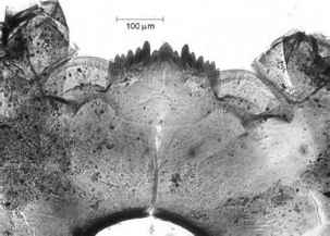 Stomatocyst