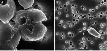 Phaeocystis