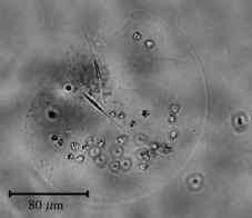 Phaeocystis